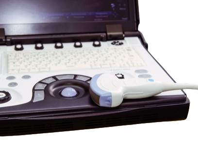 fetal heart detector